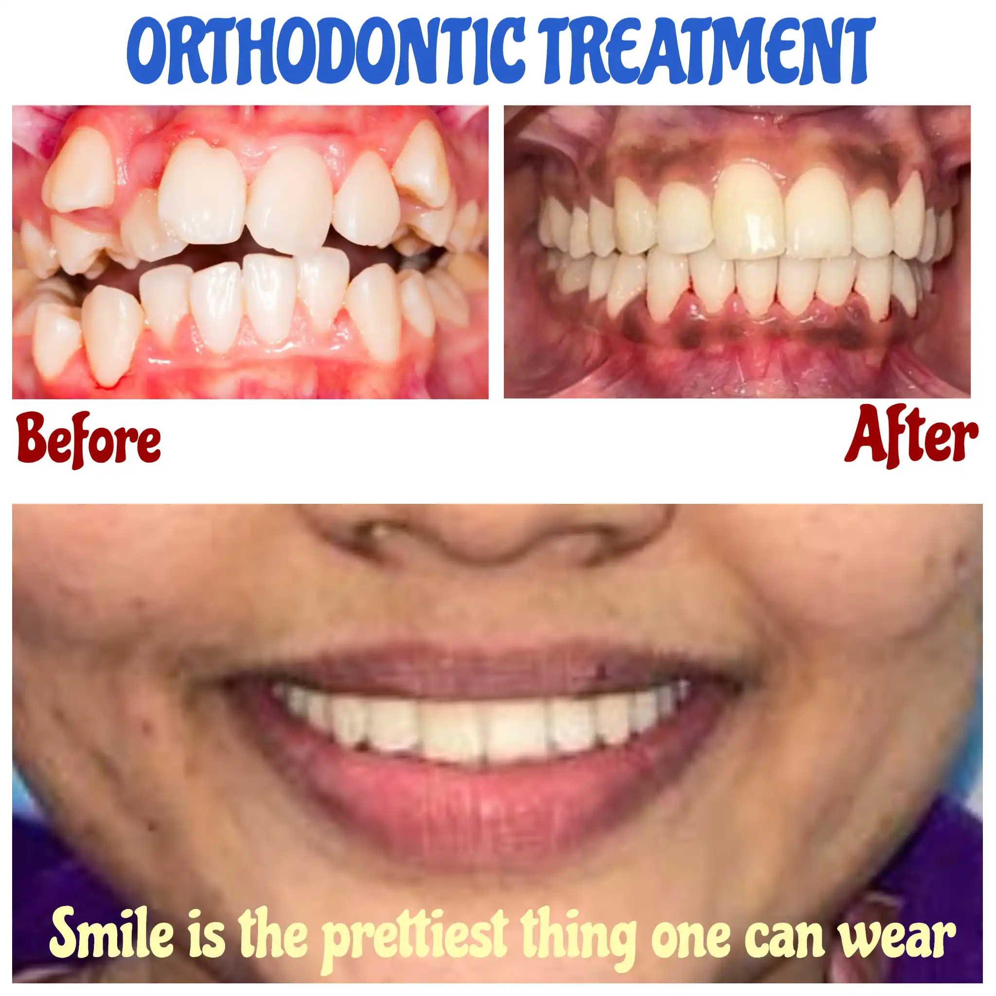 orthodontic treatment